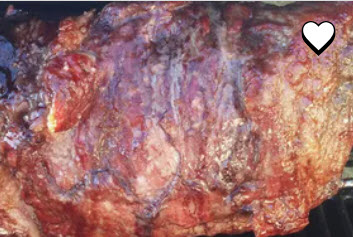 North Carolina-Style Pulled Pork
